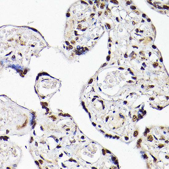 TBX20 Rabbit polyclonal antibody