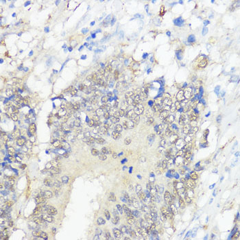 GPX2 Rabbit polyclonal antibody