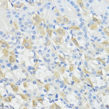 GPX2 Rabbit polyclonal antibody
