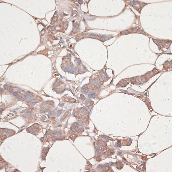 LAMC1 Rabbit polyclonal antibody