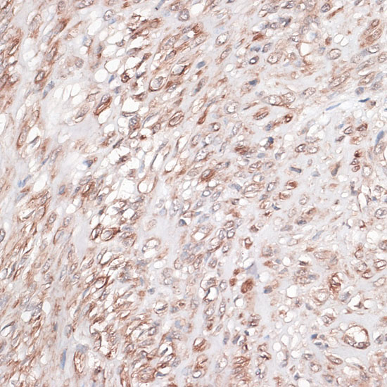 LAMC1 Rabbit polyclonal antibody