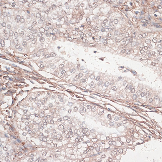 LAMC1 Rabbit polyclonal antibody