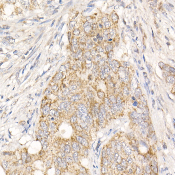 PGAM5 Rabbit polyclonal antibody
