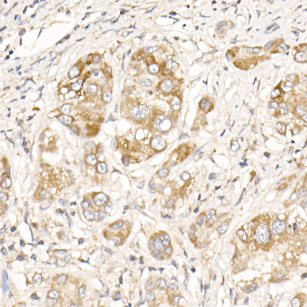 PGAM5 Rabbit polyclonal antibody
