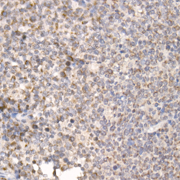 PGAM5 Rabbit polyclonal antibody