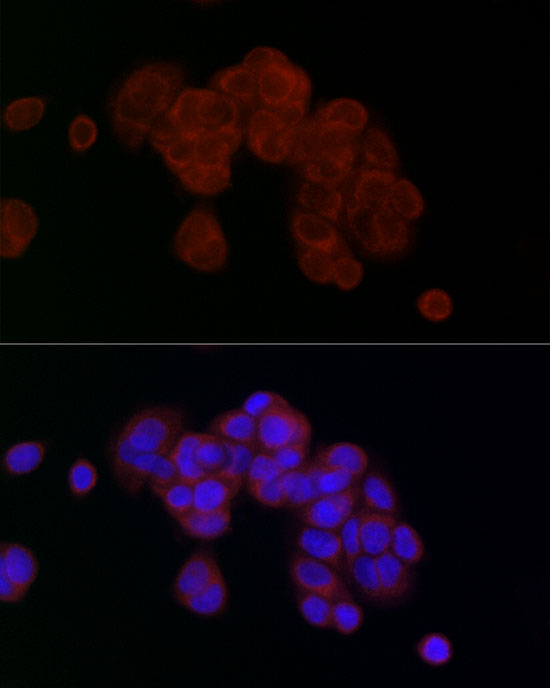 PGAM5 Rabbit polyclonal antibody