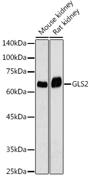 GLS2 Rabbit polyclonal antibody