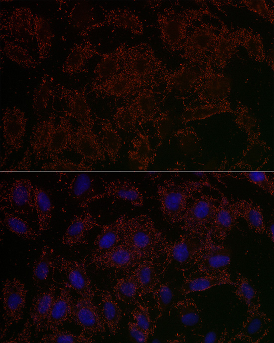 GLS2 Rabbit polyclonal antibody