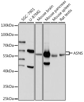 ASNS Rabbit polyclonal antibody