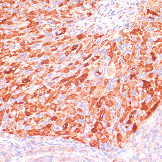 ASNS Rabbit polyclonal antibody