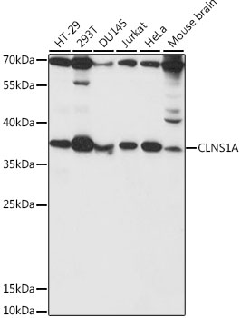 CLNS1A Rabbit polyclonal antibody