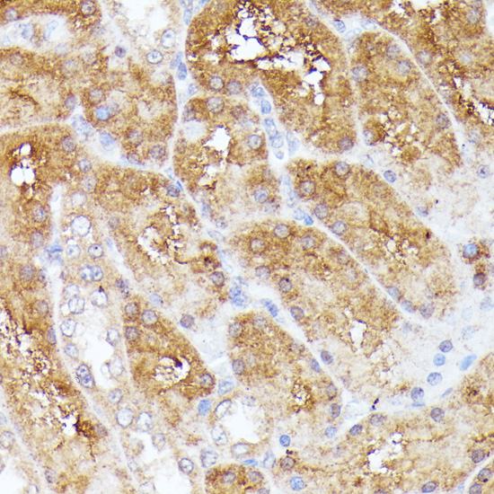 CLNS1A Rabbit polyclonal antibody