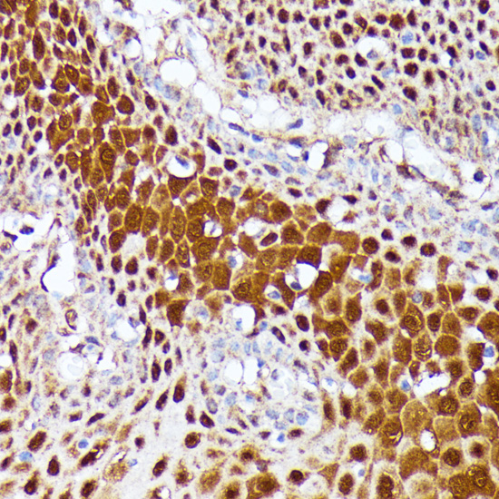 CLNS1A Rabbit polyclonal antibody