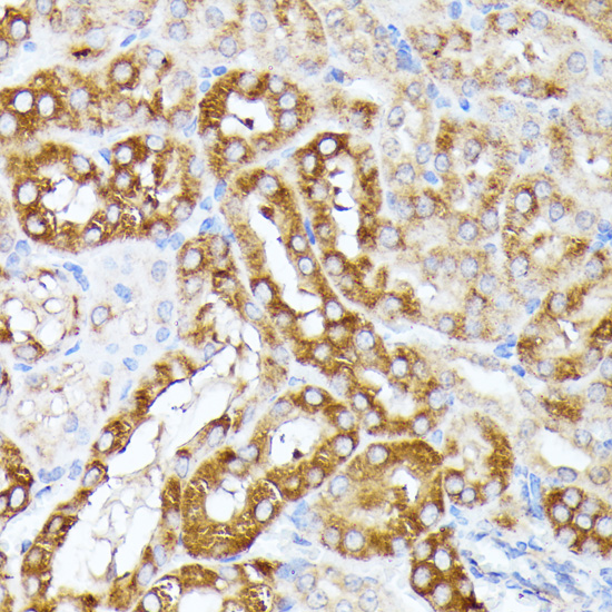 CLNS1A Rabbit polyclonal antibody