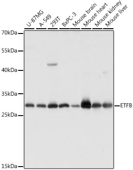 ETFB Rabbit polyclonal antibody
