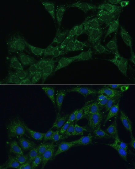 ETFB Rabbit polyclonal antibody