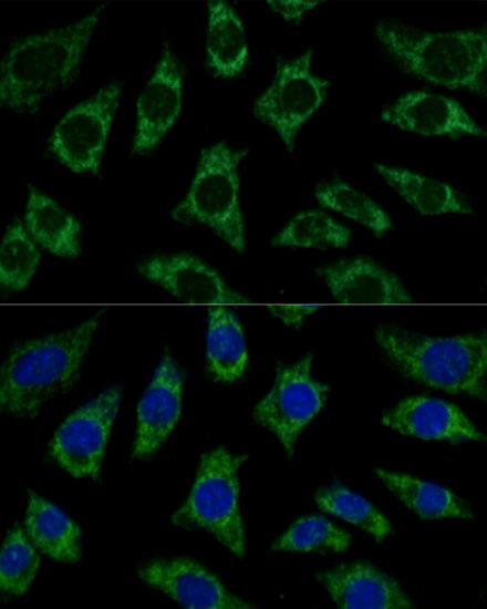 ETFB Rabbit polyclonal antibody