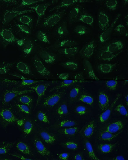 ETFB Rabbit polyclonal antibody