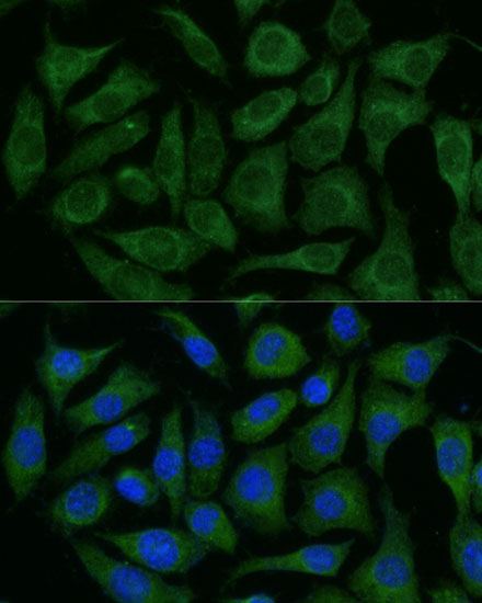 RAPGEF1 Rabbit polyclonal antibody