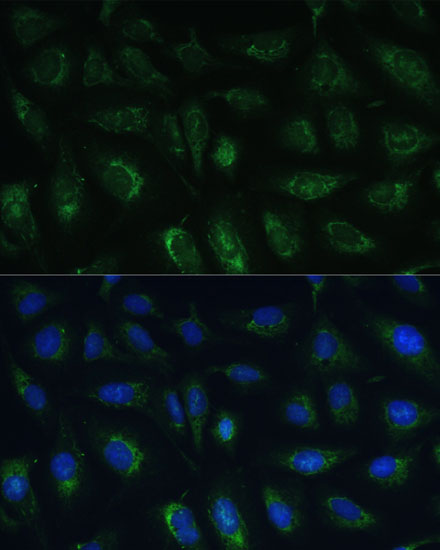 RAPGEF1 Rabbit polyclonal antibody