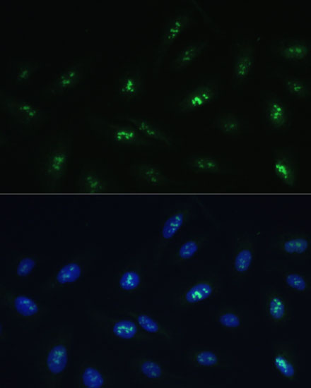 HNF4G Rabbit polyclonal antibody