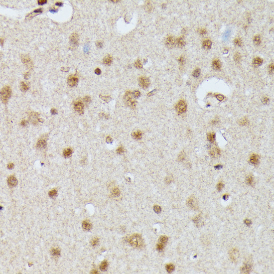 IGHMBP2 Rabbit polyclonal antibody