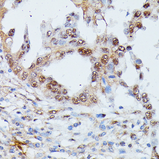 IGHMBP2 Rabbit polyclonal antibody