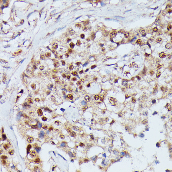 IGHMBP2 Rabbit polyclonal antibody