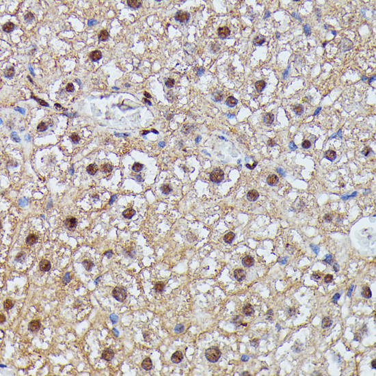 IGHMBP2 Rabbit polyclonal antibody
