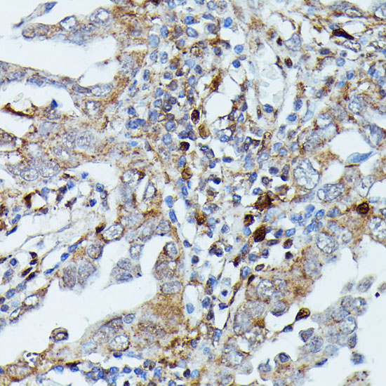 MEKK3 Rabbit polyclonal antibody