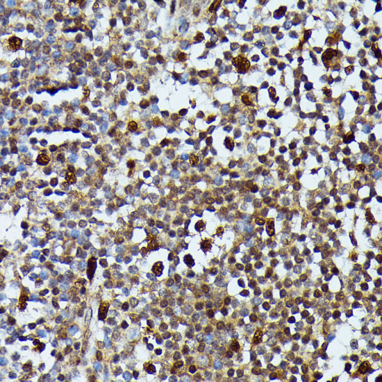 MEKK3 Rabbit polyclonal antibody