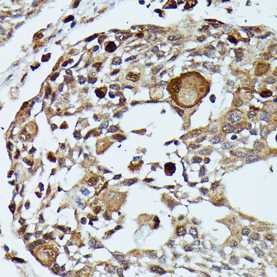 MEKK3 Rabbit polyclonal antibody