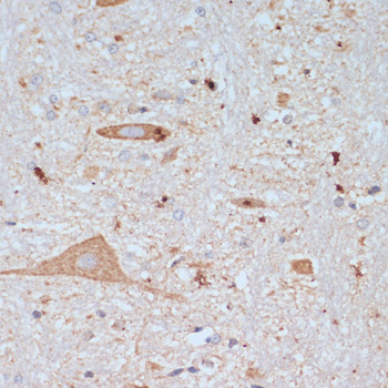 SLC18A3 Rabbit polyclonal antibody