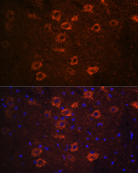 SLC18A3 Rabbit polyclonal antibody