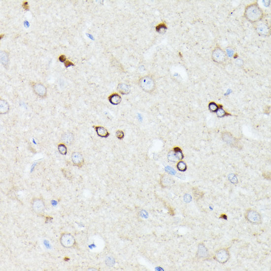 CCDC6 Rabbit polyclonal antibody