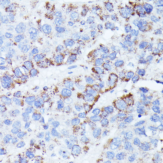 CCDC6 Rabbit polyclonal antibody
