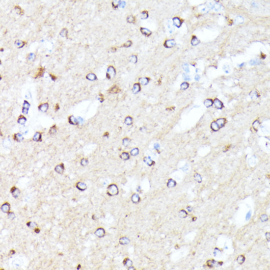 CCDC6 Rabbit polyclonal antibody