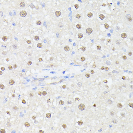 MLF2 Rabbit polyclonal antibody