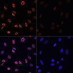 Western blot - Acetyl-Histone H3-K36 Rabbit pAb (A16077)