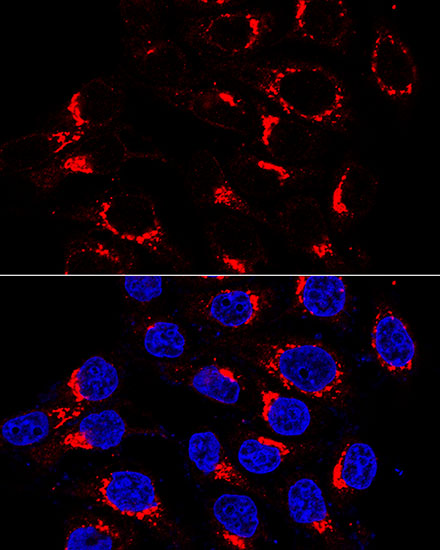 USO1 Rabbit polyclonal antibody