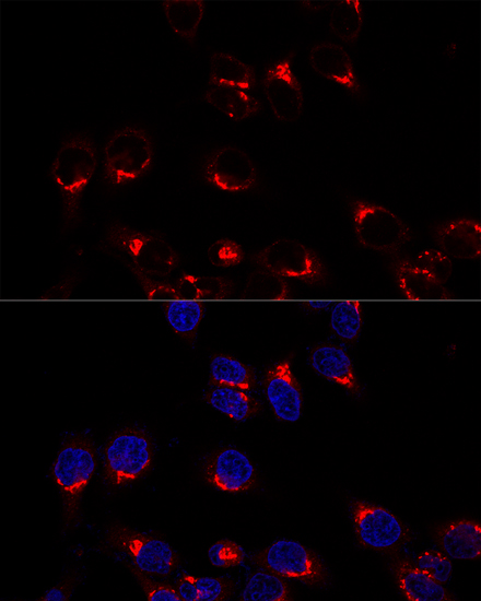 USO1 Rabbit polyclonal antibody