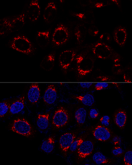 USO1 Rabbit polyclonal antibody