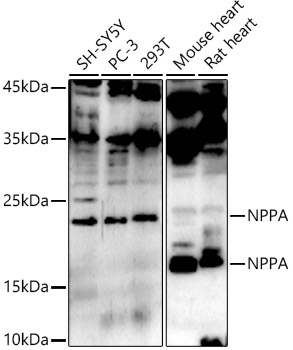 NPPA Rabbit polyclonal antibody