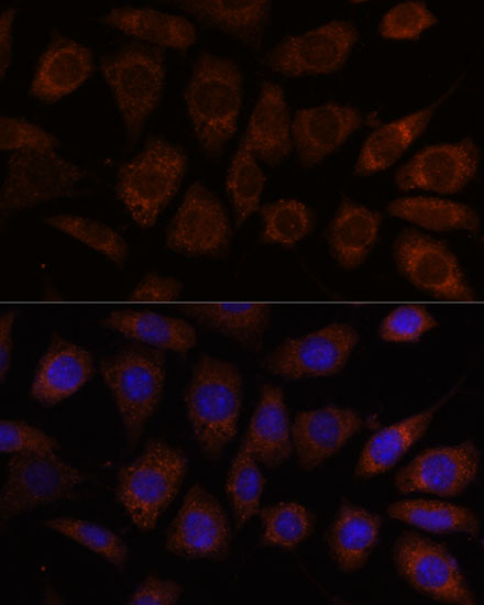 SEC24D Rabbit polyclonal antibody