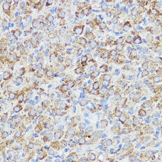ABI1 Rabbit polyclonal antibody