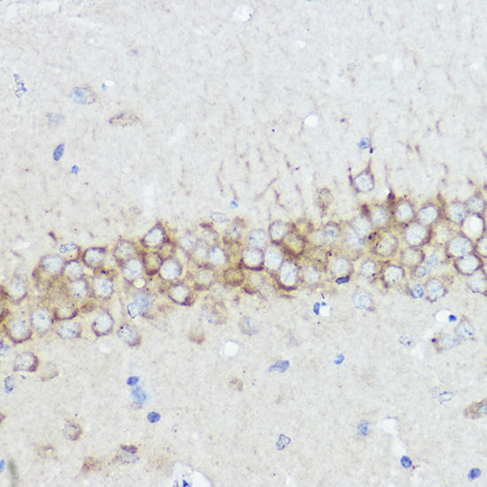 ABI1 Rabbit polyclonal antibody