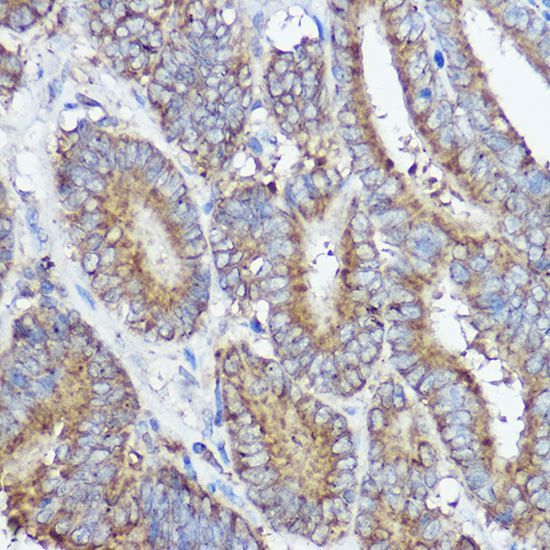 ABI1 Rabbit polyclonal antibody
