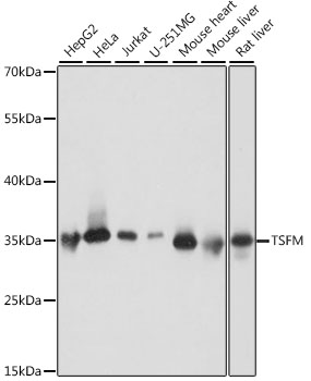 TSFM Rabbit polyclonal antibody