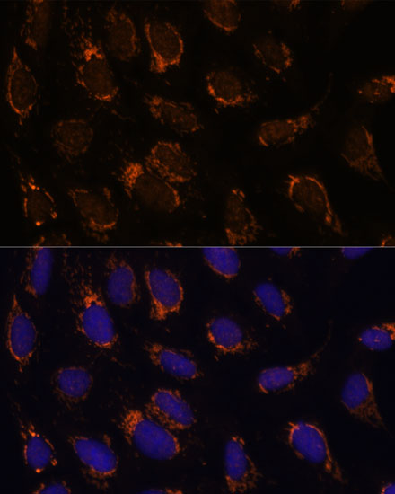 TSFM Rabbit polyclonal antibody