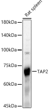 TAP2 Rabbit polyclonal antibody
